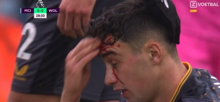 Max Kilman ficou a sangrar após choque de cabeças com Rúben Neves no Manchester City-Woolverhampton