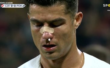 Cristiano Ronaldo a sangrar no República Checa-Portugal