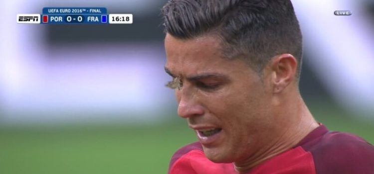 Cristiano Ronaldo na final do Euro 2016 com a traça na cara