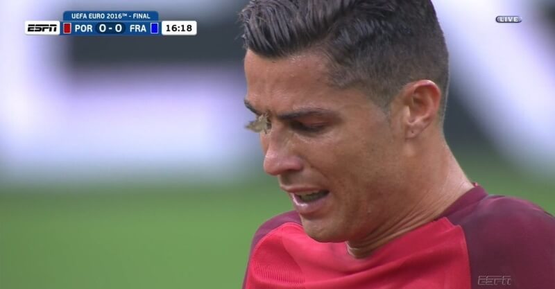 Cristiano Ronaldo na final do Euro 2016 com a traça na cara